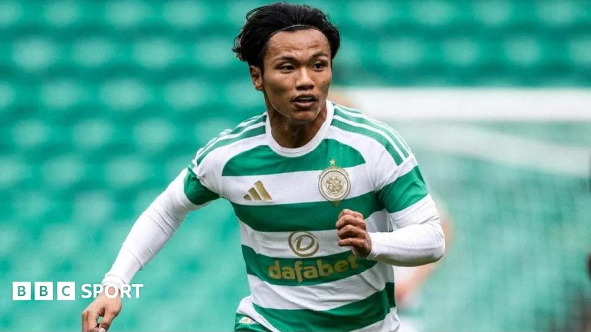 Futbolçu oyun zamanı irəliləyir, Celtic forması geyinib Futbolçu oyun zamanı irəliləyir, Celtic forması geyinib